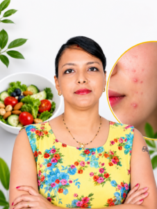 Best dietitians Delhi